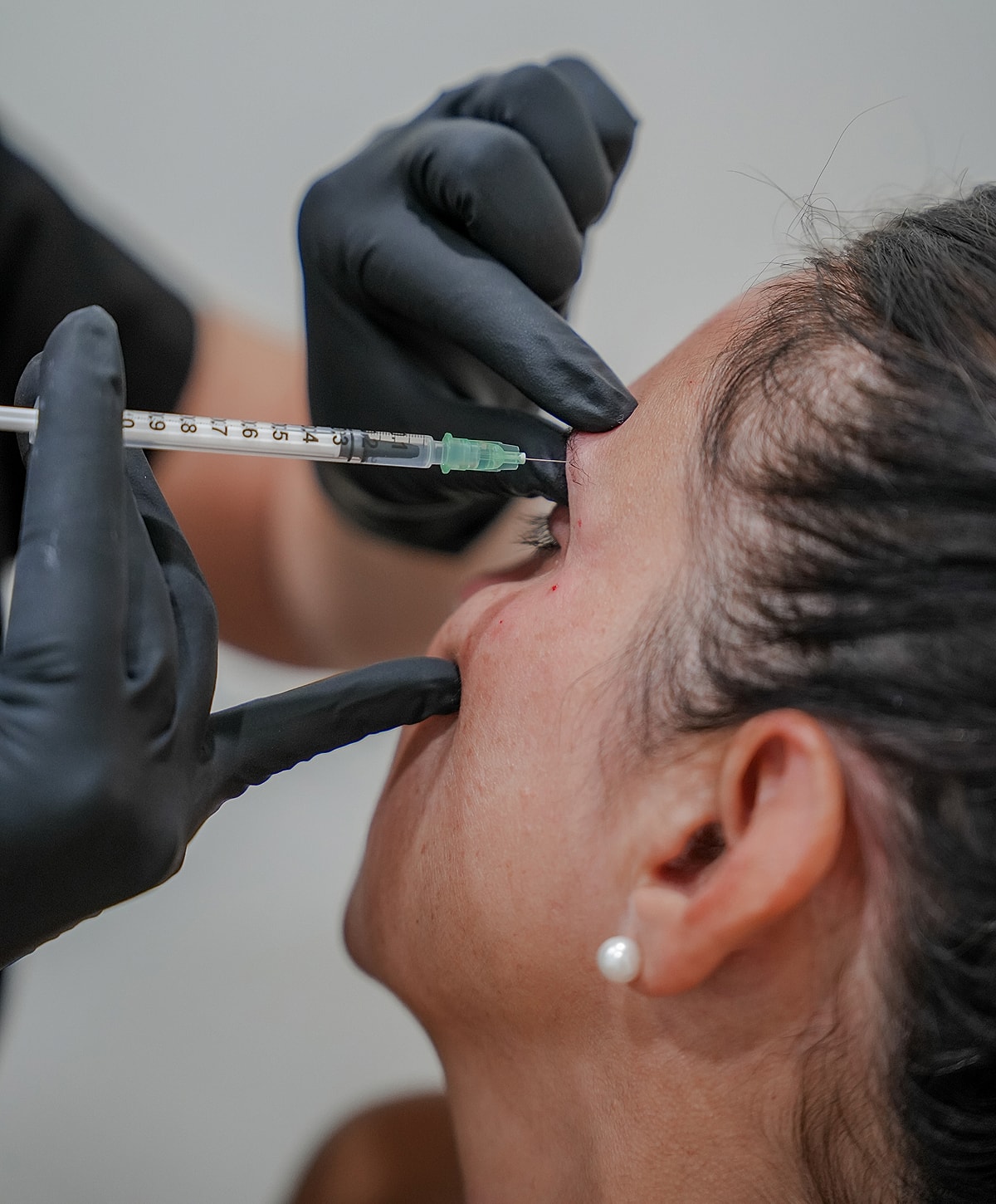Injecting cosmetic treatment into a woman's forehead