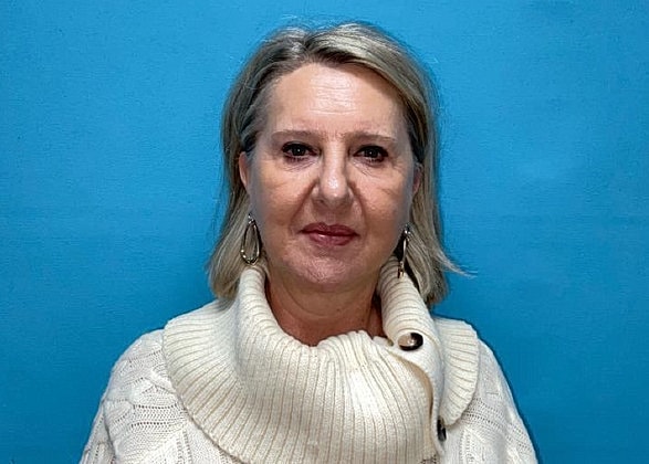 Facelift Before & After