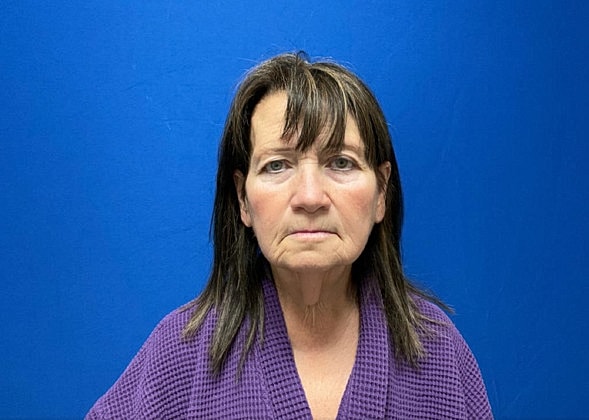 Facelift Before & After