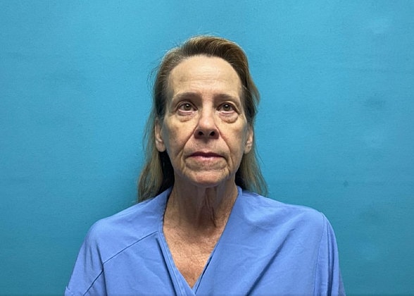 Facelift Before & After