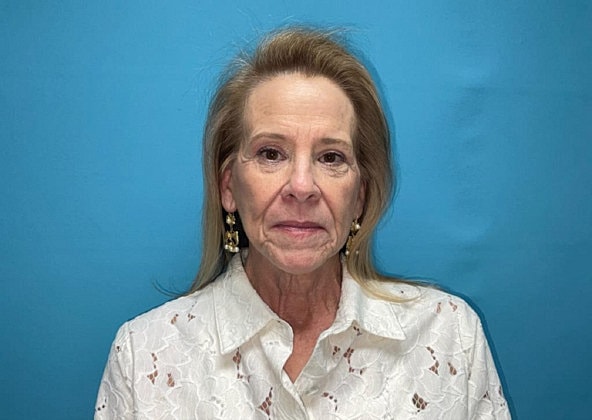 Facelift Before & After