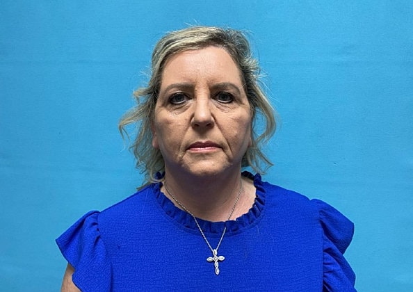 Facelift Before & After