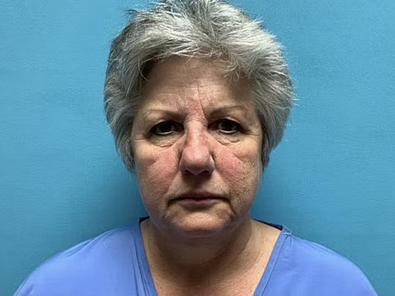 Facelift Before & After