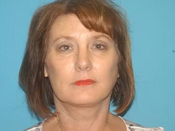 Facelift Before & After