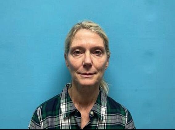 Facelift Before & After