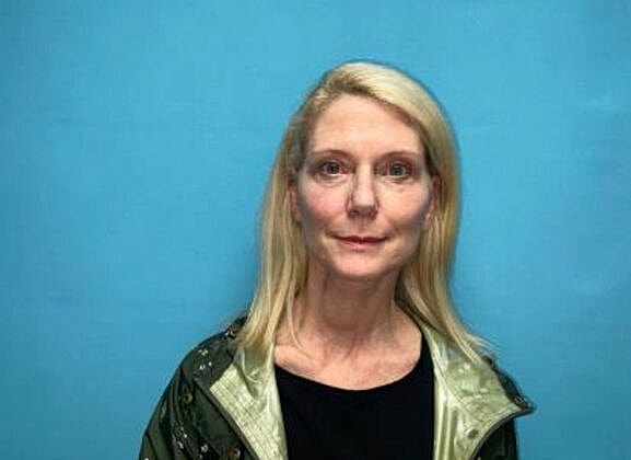Facelift Before & After