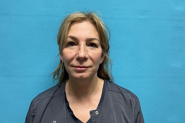 Blepharoplasty Before & After