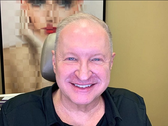 Blepharoplasty Before & After