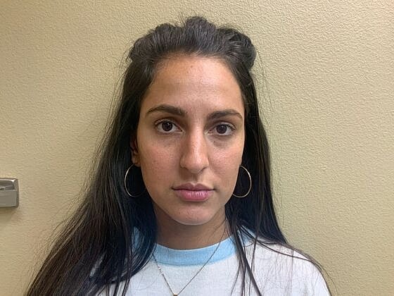Dermal Filler Before & After