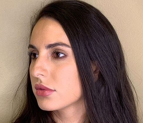 Dermal Filler Before & After