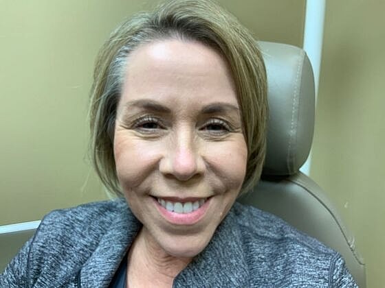 Botox Before & After