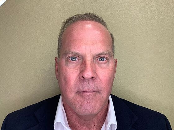 Botox Before & After