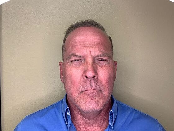 Botox Before & After