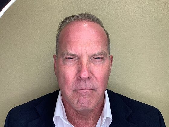 Botox Before & After