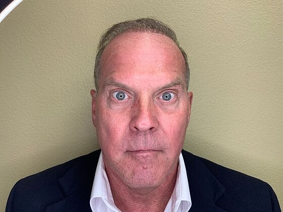Botox Before & After