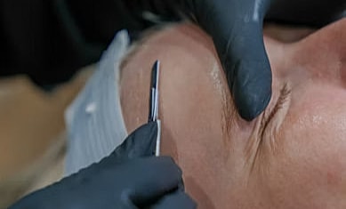 Woman getting a dermaplane facial
